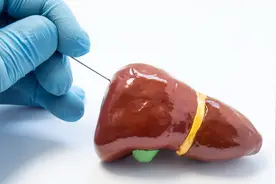 谷丙转氨酶与谷草转氨酶，哪个升高更危险？如何做才能降下来？图片