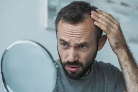 男性脱发，是雄激素过多惹的祸？图片