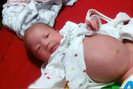 新生宝宝6种“怪现象”，家长要“见怪不怪”，正确护理才不坑娃图片