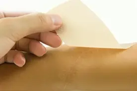 用疤痕贴淡化疤痕？是智商税还是真的有用？图片