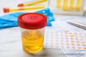 能够控制尿蛋白的中成药有哪些？图片
