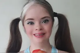 最美的唐氏综合症，她要成为国际模特，天使面孔不再千篇一律图片