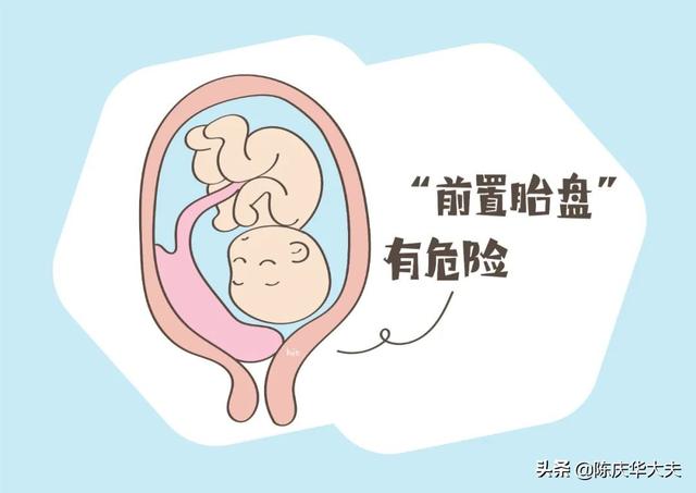 前置胎盘能顺产吗？