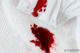 排卵期出血有两种原因图片