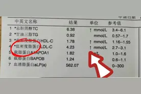 血脂化验单/如何看低密度脂蛋白图片