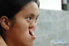 陕西夫妻捡到坑面女孩,哥哥做苦力为妹妹整容,长大后妹妹嫁给哥哥图片