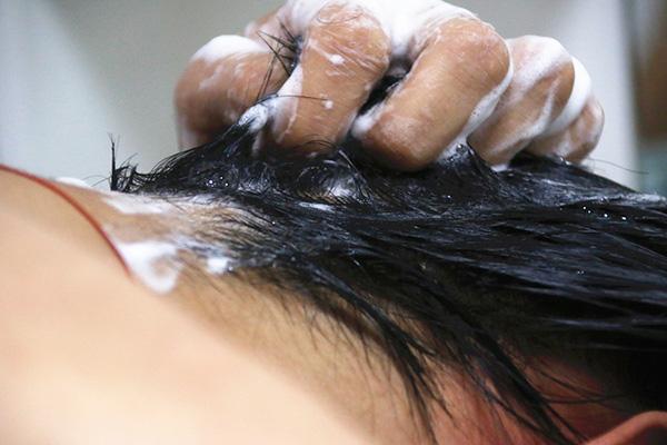 头发发痒掉头发怎么办