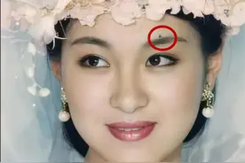 脸上的痣 不能随便去掉！如果长在这6个地方，那真是老天送的礼物图片