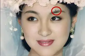 脸上的痣 不能随便去掉！如果长在这6个地方，那真是老天送的礼物图片