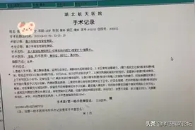 5小时脊柱侧弯矫正术，18岁“驼背”女孩挺直胸膛图片