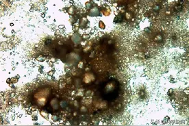 洗澡搓下来的黑泥到底是什么？显微镜放大100倍，画面不忍直视图片