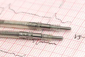 60岁的人，心率多少算正常？心率慢会长寿吗？心血管医生告诉你图片