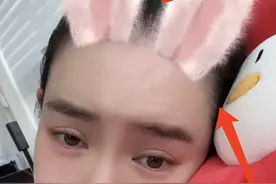 戚薇二胎产后未瘦至90斤压力大，脱发严重头皮抢镜，发际线上移图片