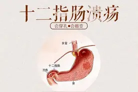 什么是十二指肠溃疡？身体出现这4大症状，多是它在作祟图片