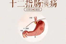 什么是十二指肠溃疡？身体出现这4大症状，多是它在作祟图片