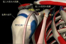 肱二头肌腱炎的症状、起因及康复手段图片