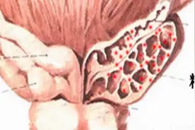 精液固体化正常吗？固体化的原因有哪些？图片