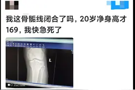 20岁小伙净身高才169？骨骺线闭合后，还能再长高吗？图片