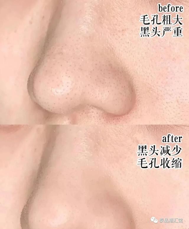 娉板浗Vlanse Q10鐗涘ザ娲楅潰濂剁敺濂?娓呮磥琛ユ按淇濇箍姘ㄥ熀閰告磥闈钩