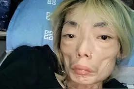 瘦到病态，动脸成瘾，切胃、剪肠产上阵，内娱的畸形审美真可怕图片