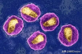 新冠还没消停，最强艾滋病（HIV变体）已致109人感染，如何防御？图片