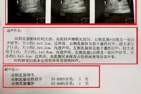 乳腺B超报告单15大名词解读，90%的人不知道！图片
