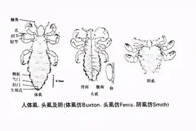 ​22岁小伙长虱子，治、排毒花费近8万元，为什么会有虱子？图片