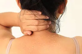 头颈部爱出汗，头发经常打湿？中医：或是5个原因，教你有效止汗图片