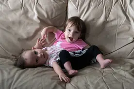 一个死去，另一个能活下来吗？浙江连体女婴，妹妹20年后结婚生子图片