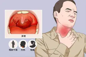 慢性咽炎多是气出来的，3个奇效中成药，横扫各种咽炎图片