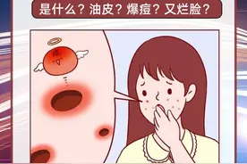 油痘肌是什么？油皮！爆痘图片