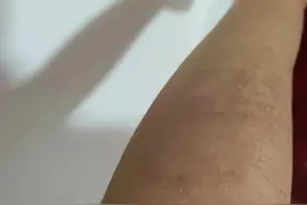 湿疹自救经验分享（超省钱版本）图片