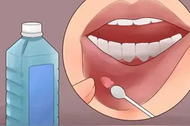 体内有癌，嘴先知？提醒：口腔出现这5种迹象，可能是癌症在靠近图片