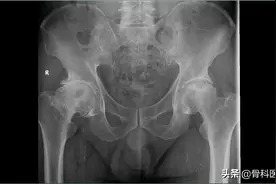 医学影像图片共分享（一）图片