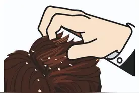 急急急！头皮屑很多，究竟怎么办？看完这篇你有救了图片