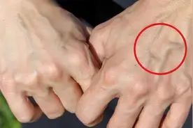 有的人手臂“青筋暴起”，而有的人几乎看不到青筋，哪种更健康呢图片