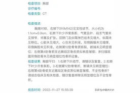 31岁的她突然查出1.1cm肺结节，一个月后翻倍长到2cm，被吓坏了图片