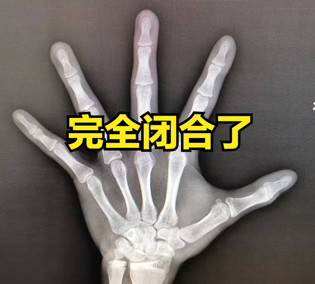 男孩变声长喉结后，女孩来月经后，分别还能长多少？家长心中有数