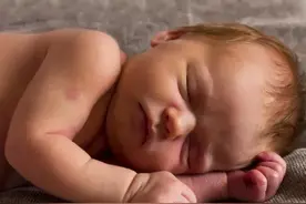 新生儿黄疸怎么办？宝妈们要注意了图片