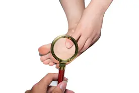 脚趾缝发白糜烂，又臭又痒怎么办？医生教你几招轻松缓解图片