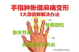 晨起手发胀、僵硬、握不拢、咔咔响？三种原因多见，解决办法如下图片