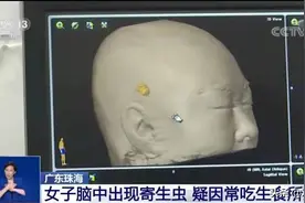 这6类食物容易有寄生虫，最后1类少有人知道图片