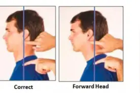 3分钟掌握头部前倾纠正方法图片