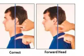 3分钟掌握头部前倾纠正方法图片