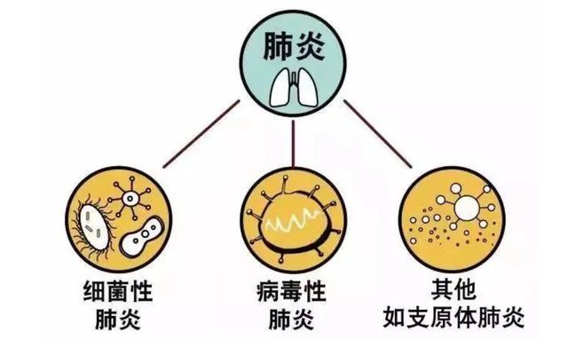 肺炎是什么病?（什么是肺炎有哪些类型如何预防及治疗）