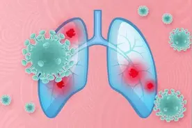 中美专家共同发现：新冠后很多人出现肺结节增多或增大的情况！应对方法公布！图片