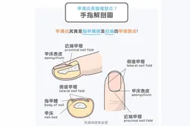 你为什么会得甲沟炎？又该如何防治呢？图片