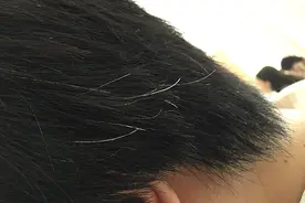 莫名长出白发，怎么办？别急着染发，做好3件事，或许还能黑回来图片