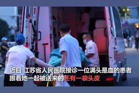 女子长发卷入机器被撕下整张头皮，迅速把头皮装袋子就医，医生：她蛮了不起，受伤后比较冷静图片