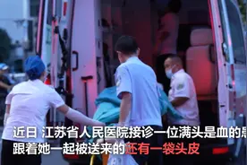 女子长发卷入机器被撕下整张头皮，迅速把头皮装袋子就医，医生：她蛮了不起，受伤后比较冷静图片